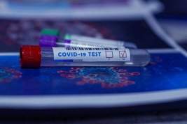 Четыре случая заражения штаммом COVID-19 «арктур» выявлены в России - к концу мая ожидают всплеск заболеваемости
