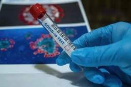 Число новых случаев заражения коронавирусом за последние сутки перевалило за 40 тысяч