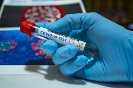 Эксперт Роспотребнадзора оценила заразность пациента с отрицательным тестом на COVID-19