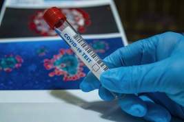 За сутки в России выявлено 23 652 случая заражения коронавирусом и 454 летальных исхода
