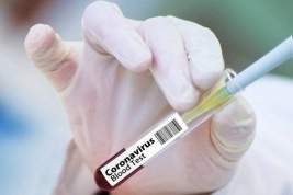 Доктор Мясников рассказал, чем отличаются тесты на коронавирус