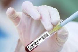 Фонд Гейтса заключил соглашение с 16 компаниями для производства вакцин от COVID-19
