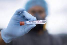 Названо два прогноза по окончанию пандемии коронавируса