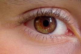Офтальмолог рассказала о серьёзных последствиях COVID-19 для глаз
