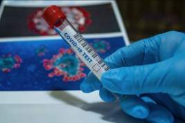 Российские лаборатории смогли рекордно заработать на коронавирусных тестах в июне