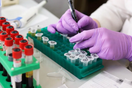 Российские учёные приступили к испытаниям теста для переболевших коронавирусом