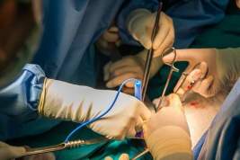 Скворцову попросили разрешить уволенному врачу-трансплантологу провести операцию по пересадке почки двоим детям