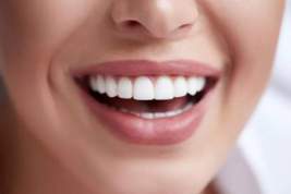 Стоматологи сообщили о вреде отбеливания зубов