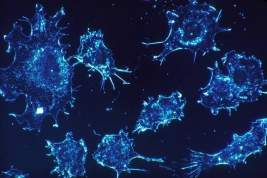 Ученые признали невозможным полное излечение от рака