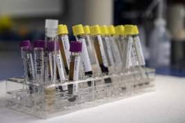 Учёные установили связь между риском заражения коронавирусом и резус-фактором