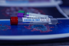 В Минздраве рассказали, сколько тестов на коронавирус дают ошибочный результат