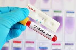 В РФ число зараженных коронавирусом приблизилось к 12 тысячам человек, в мире - более 1,6 миллиона случаев заболевания