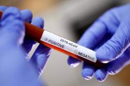 В России зарегистрировано 495 случаев заражения коронавирусом, ВОЗ сообщает более чем о 330 тысячах случаев во всем мире