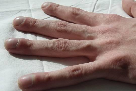 Аргентинский препарат от муковисцидоза начнут производить в России