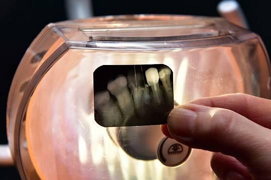 Члены одной семьи лечили людям зубы на дому по инструкциям из интернета