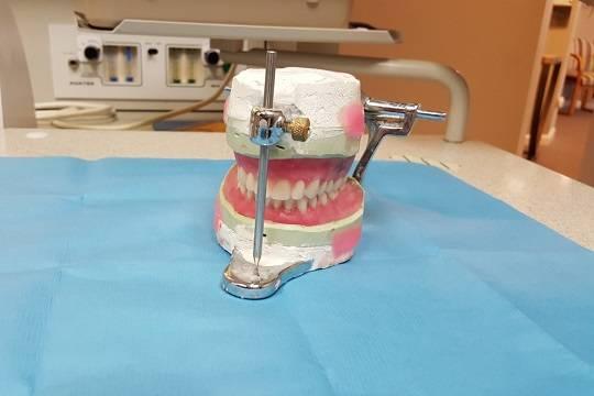 Названы категории граждан с правом на бесплатные зубные протезы