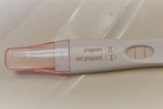 В РПЦ предложили сократить сроки аборта до девяти недель